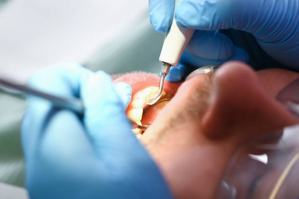 Best Emergency Root Canal Treatment in Frontenac, KS