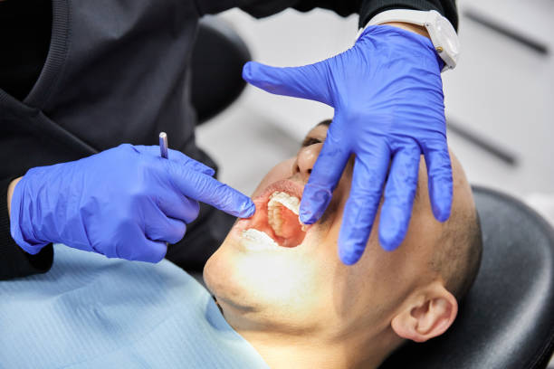 Best Emergency Wisdom Teeth Removal in Frontenac, KS