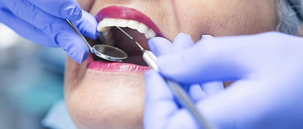 Best Emergency Tooth Extraction in Frontenac, KS